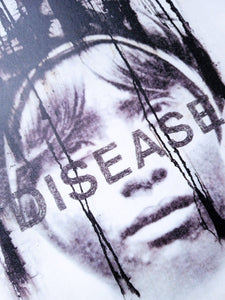 Jaume PLENSA. Disease, 2006. Litografía